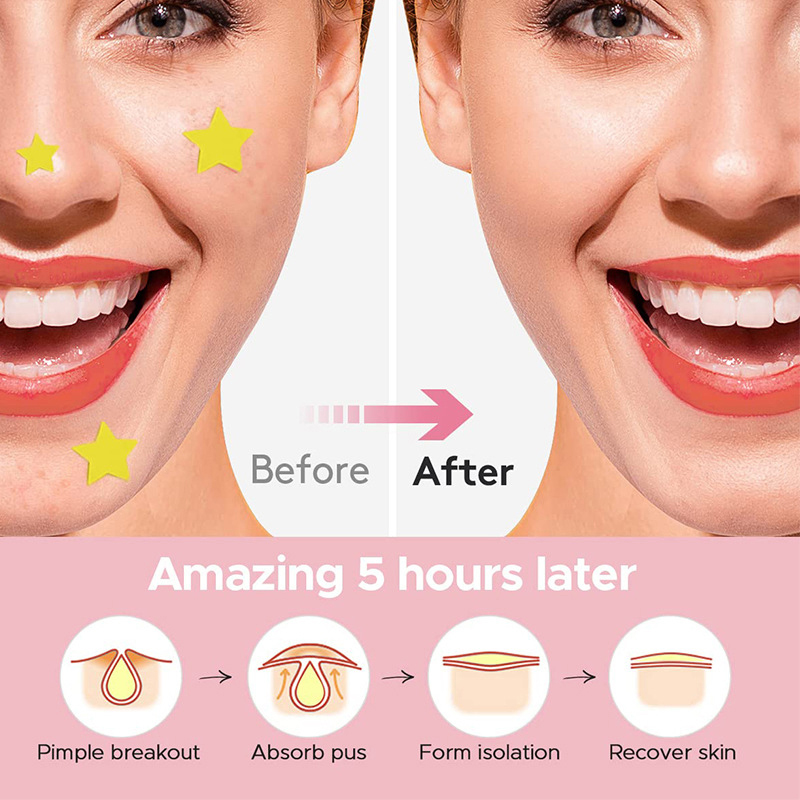600 adet/takım yıldız sivilce  - Makeup Beauty Set incelemesi ve fiyatı